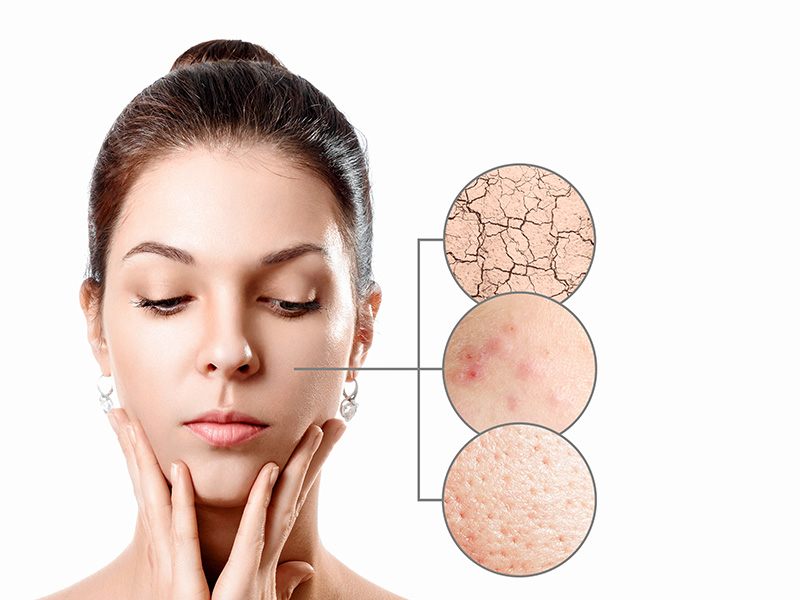 Bőrünk egészsége – Hogyan csökkentsük a ráncokat természetesen?